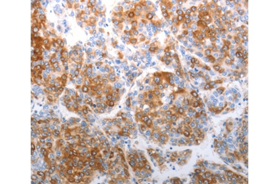 Immunohistochemistry - CHD5 Antibody from Signalway Antibody (37208) - Antibodies.com