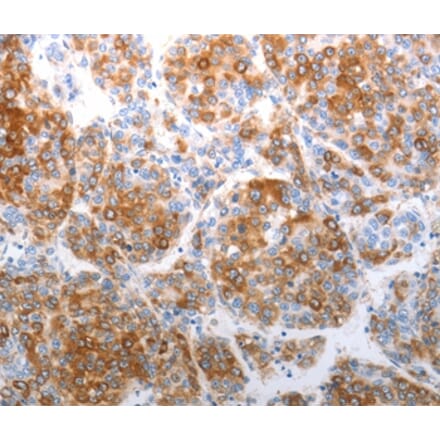 Immunohistochemistry - CHD5 Antibody from Signalway Antibody (37208) - Antibodies.com