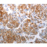 Immunohistochemistry - CHD5 Antibody from Signalway Antibody (37208) - Antibodies.com