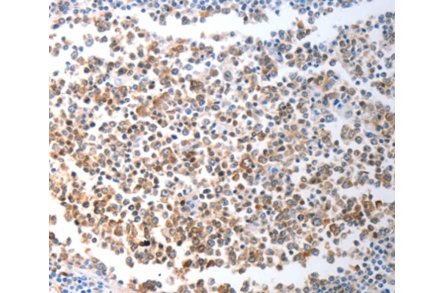 Immunohistochemistry - CHD5 Antibody from Signalway Antibody (37208) - Antibodies.com