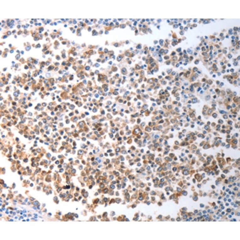 Immunohistochemistry - CHD5 Antibody from Signalway Antibody (37208) - Antibodies.com