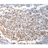 Immunohistochemistry - CHD5 Antibody from Signalway Antibody (37208) - Antibodies.com