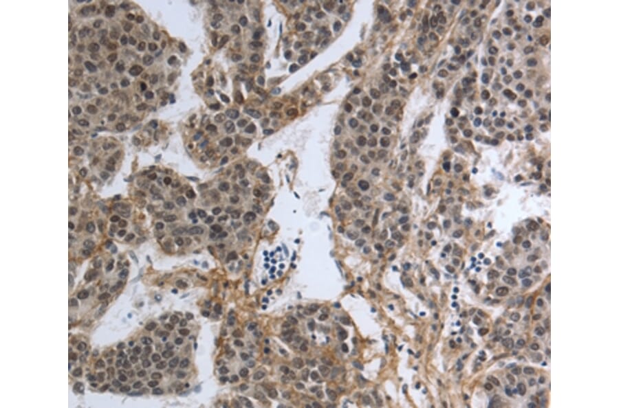 Immunohistochemistry - PMS2 Antibody from Signalway Antibody (37216) - Antibodies.com