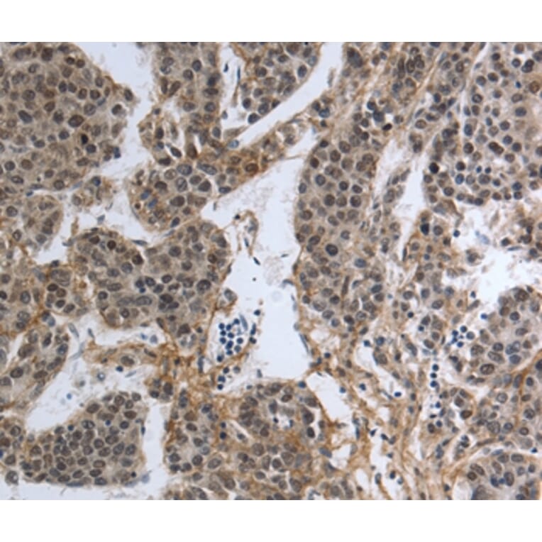 Immunohistochemistry - PMS2 Antibody from Signalway Antibody (37216) - Antibodies.com