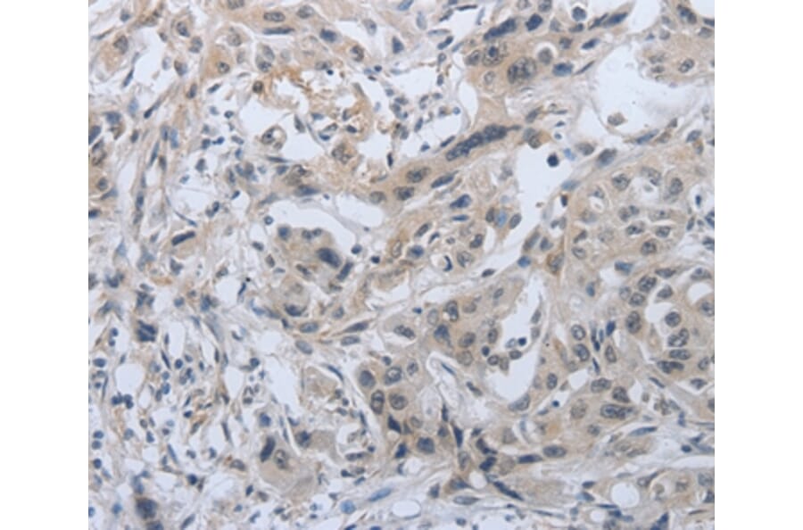 Immunohistochemistry - PMS2 Antibody from Signalway Antibody (37216) - Antibodies.com