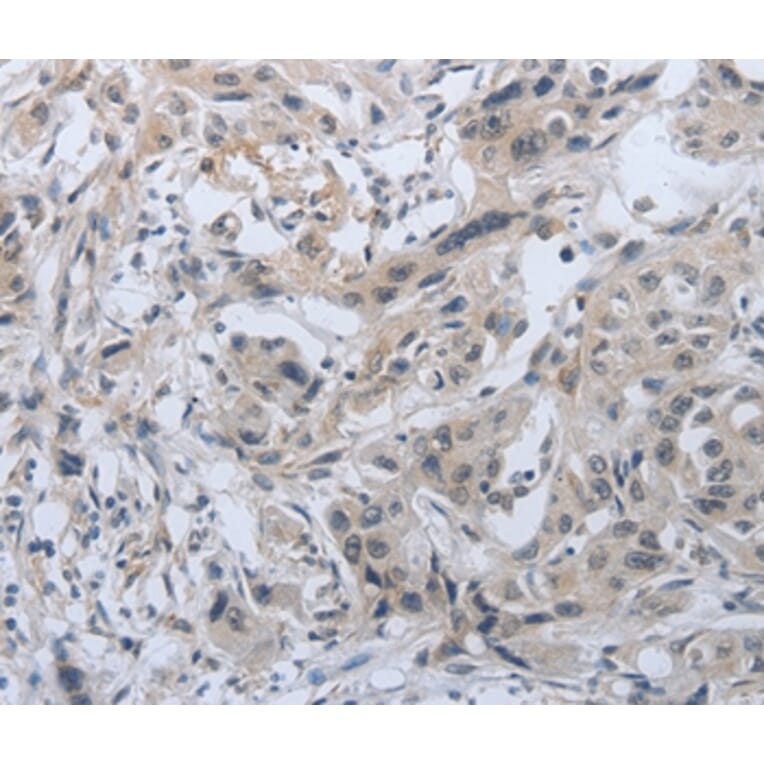 Immunohistochemistry - PMS2 Antibody from Signalway Antibody (37216) - Antibodies.com