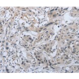 Immunohistochemistry - PMS2 Antibody from Signalway Antibody (37216) - Antibodies.com