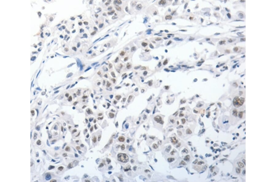 Immunohistochemistry - PKD2 Antibody from Signalway Antibody (37217) - Antibodies.com