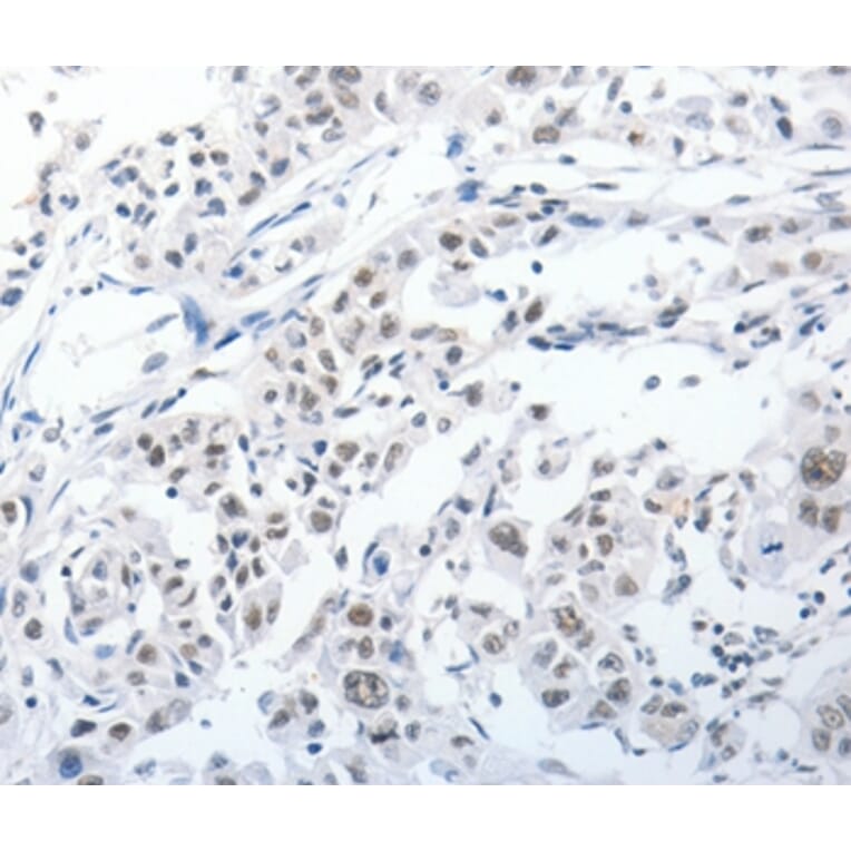Immunohistochemistry - PKD2 Antibody from Signalway Antibody (37217) - Antibodies.com