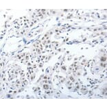Immunohistochemistry - PKD2 Antibody from Signalway Antibody (37217) - Antibodies.com