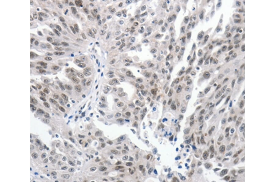 Immunohistochemistry - PKD2 Antibody from Signalway Antibody (37217) - Antibodies.com