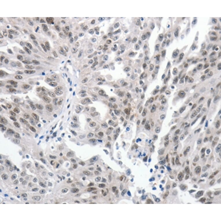 Immunohistochemistry - PKD2 Antibody from Signalway Antibody (37217) - Antibodies.com