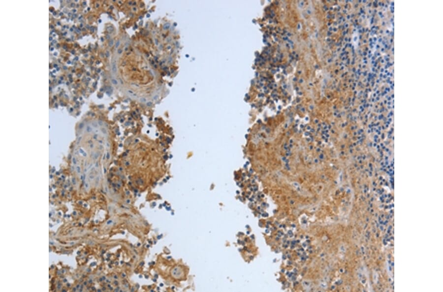 Immunohistochemistry - DLG4 Antibody from Signalway Antibody (37222) - Antibodies.com