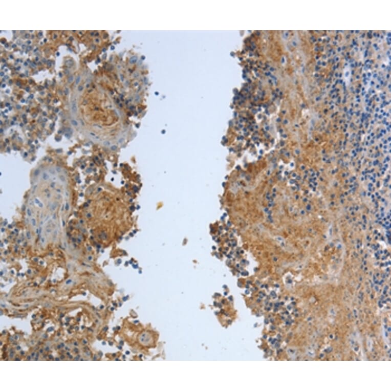 Immunohistochemistry - DLG4 Antibody from Signalway Antibody (37222) - Antibodies.com