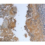 Immunohistochemistry - DLG4 Antibody from Signalway Antibody (37222) - Antibodies.com