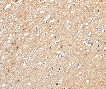 Immunohistochemical analysis of paraffin-embedded Human brain tissue using #37229 at dilution 1/30.