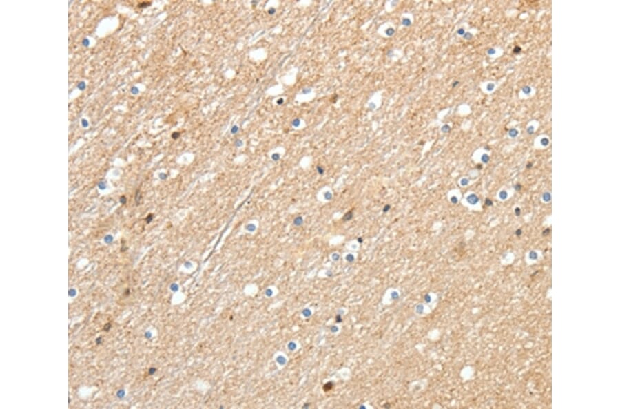 Immunohistochemistry - RRAD Antibody from Signalway Antibody (37229) - Antibodies.com