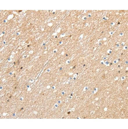 Immunohistochemistry - RRAD Antibody from Signalway Antibody (37229) - Antibodies.com