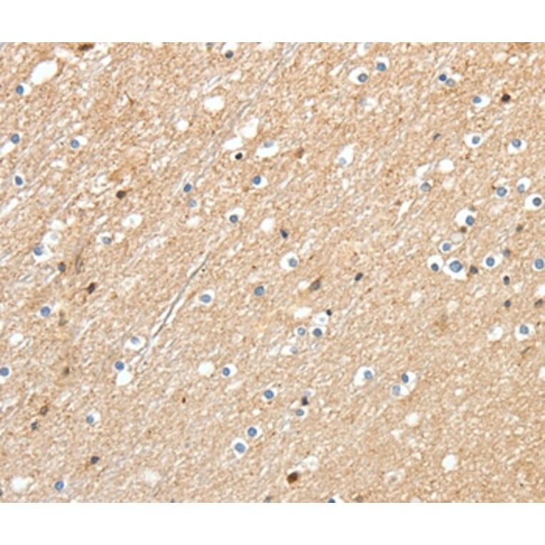 Immunohistochemistry - RRAD Antibody from Signalway Antibody (37229) - Antibodies.com