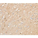 Immunohistochemistry - RRAD Antibody from Signalway Antibody (37229) - Antibodies.com