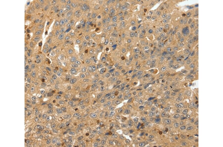 Immunohistochemistry - RRAD Antibody from Signalway Antibody (37229) - Antibodies.com