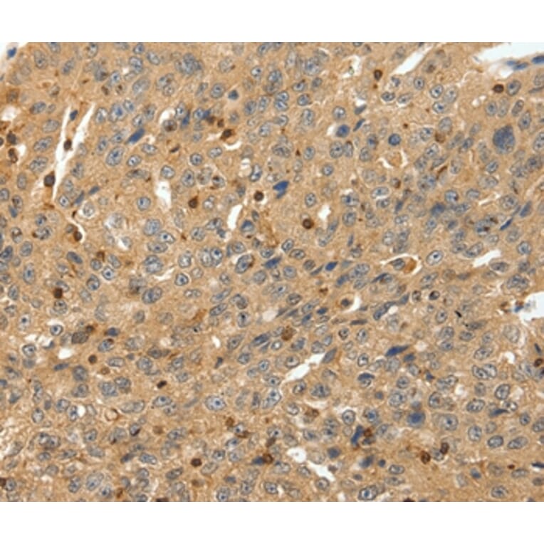 Immunohistochemistry - RRAD Antibody from Signalway Antibody (37229) - Antibodies.com