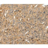 Immunohistochemistry - RRAD Antibody from Signalway Antibody (37229) - Antibodies.com