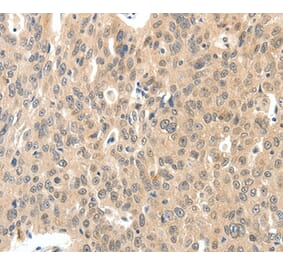 Immunohistochemistry - ROS1 Antibody from Signalway Antibody (37230) - Antibodies.com