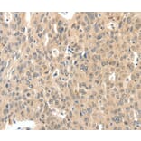 Immunohistochemistry - ROS1 Antibody from Signalway Antibody (37230) - Antibodies.com