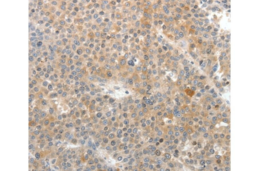Immunohistochemistry - SV2A Antibody from Signalway Antibody (37263) - Antibodies.com