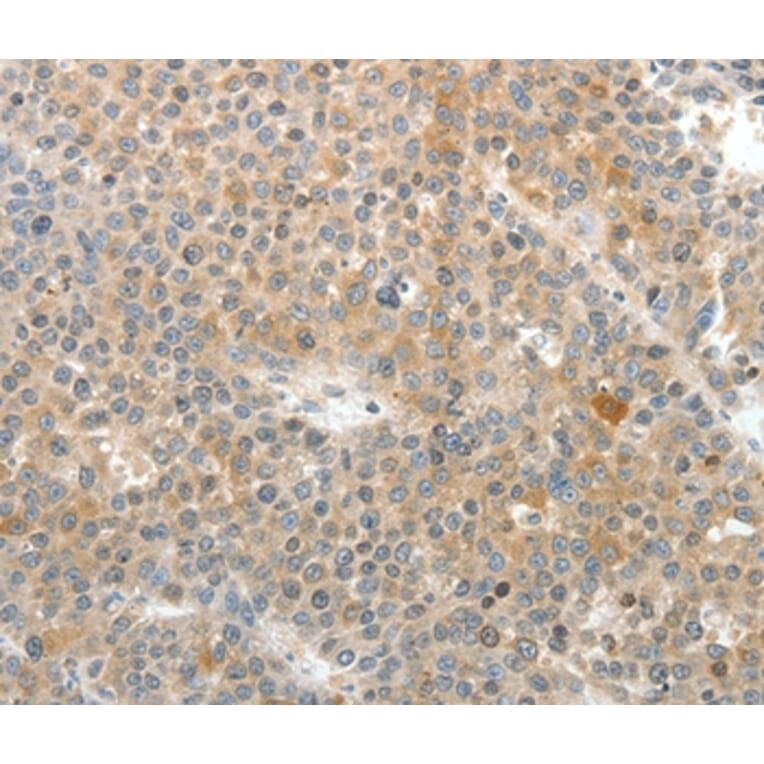 Immunohistochemistry - SV2A Antibody from Signalway Antibody (37263) - Antibodies.com