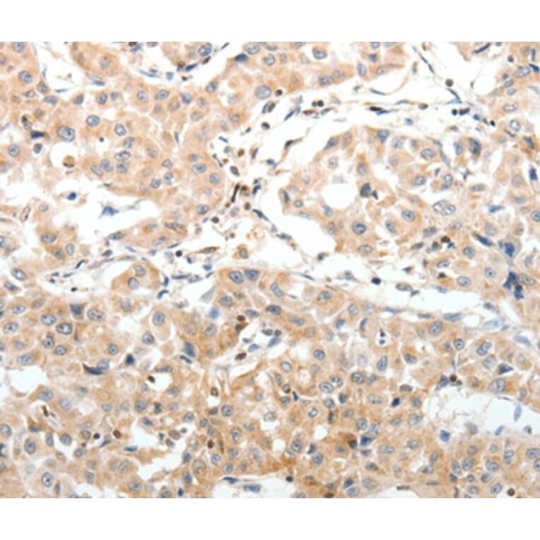 Immunohistochemistry - SV2A Antibody from Signalway Antibody (37263) - Antibodies.com