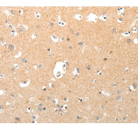 Immunohistochemistry - TNXB Antibody from Signalway Antibody (37269) - Antibodies.com