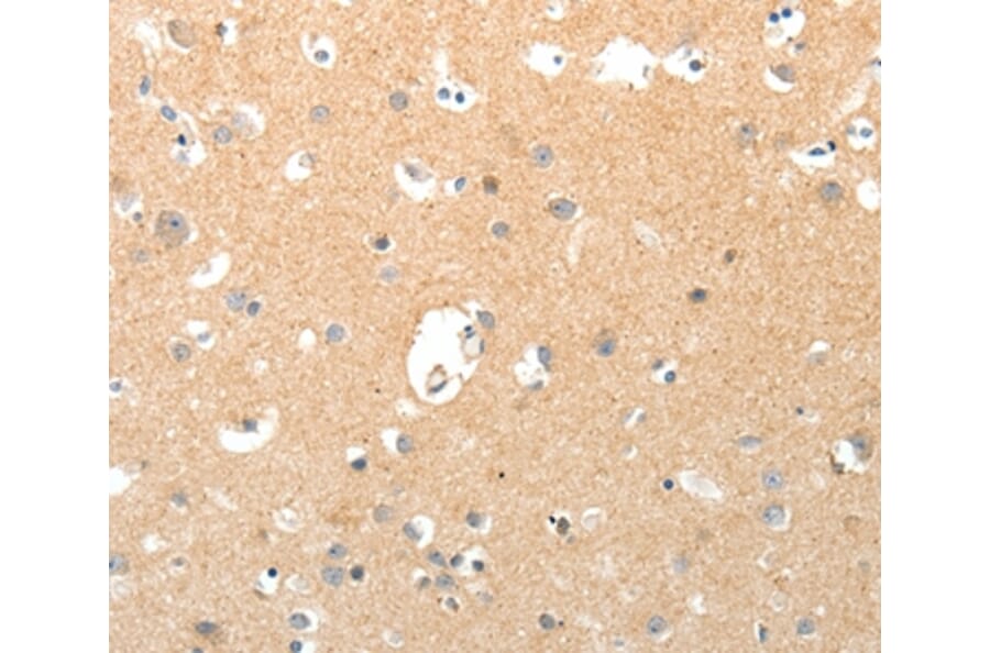 Immunohistochemistry - TNXB Antibody from Signalway Antibody (37269) - Antibodies.com