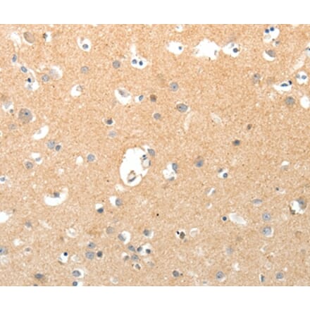 Immunohistochemistry - TNXB Antibody from Signalway Antibody (37269) - Antibodies.com