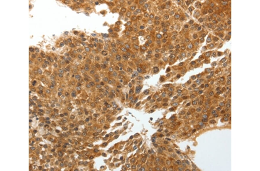 Immunohistochemistry - TNXB Antibody from Signalway Antibody (37269) - Antibodies.com