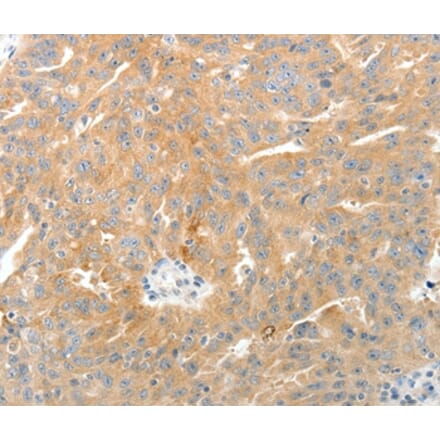 Immunohistochemistry - TEP1 Antibody from Signalway Antibody (37271) - Antibodies.com