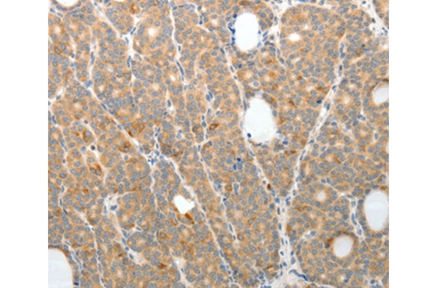 Immunohistochemistry - TEP1 Antibody from Signalway Antibody (37271) - Antibodies.com