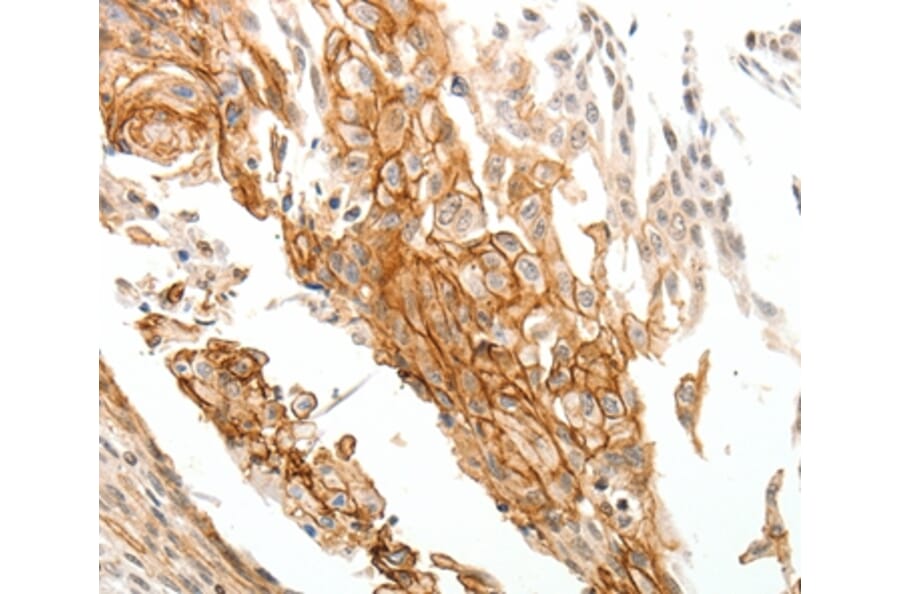 Immunohistochemistry - TGM1 Antibody from Signalway Antibody (37273) - Antibodies.com