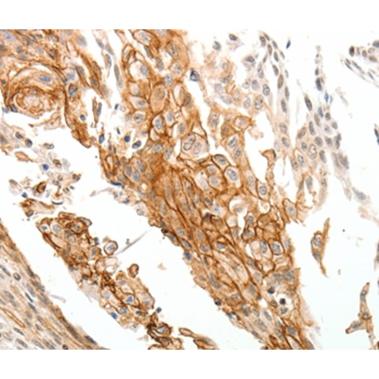 Immunohistochemistry - TGM1 Antibody from Signalway Antibody (37273) - Antibodies.com