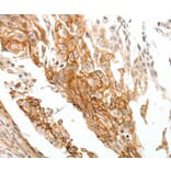 Immunohistochemistry - TGM1 Antibody from Signalway Antibody (37273) - Antibodies.com