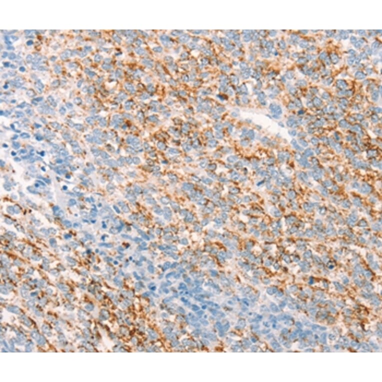 Immunohistochemistry - THY1 Antibody from Signalway Antibody (37275) - Antibodies.com