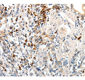 Immunohistochemistry - CD93 Antibody from Signalway Antibody (37276) - Antibodies.com