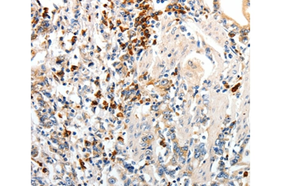 Immunohistochemistry - CD93 Antibody from Signalway Antibody (37276) - Antibodies.com
