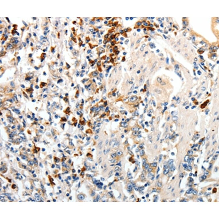 Immunohistochemistry - CD93 Antibody from Signalway Antibody (37276) - Antibodies.com