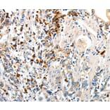 Immunohistochemistry - CD93 Antibody from Signalway Antibody (37276) - Antibodies.com