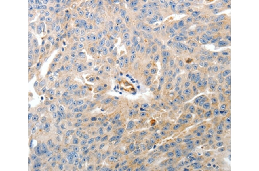 Immunohistochemistry - CD93 Antibody from Signalway Antibody (37276) - Antibodies.com