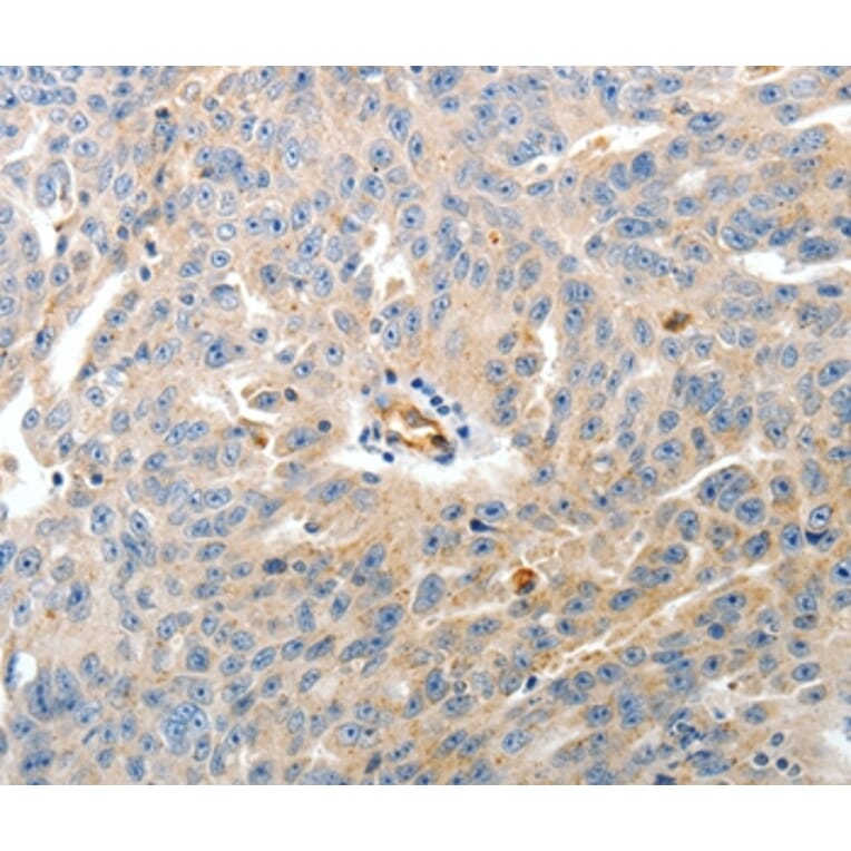 Immunohistochemistry - CD93 Antibody from Signalway Antibody (37276) - Antibodies.com