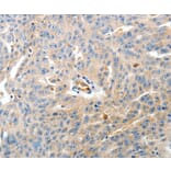 Immunohistochemistry - CD93 Antibody from Signalway Antibody (37276) - Antibodies.com