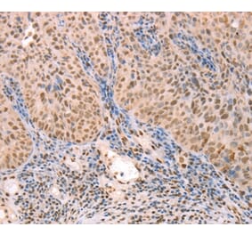 Immunohistochemistry - PTMA Antibody from Signalway Antibody (37277) - Antibodies.com